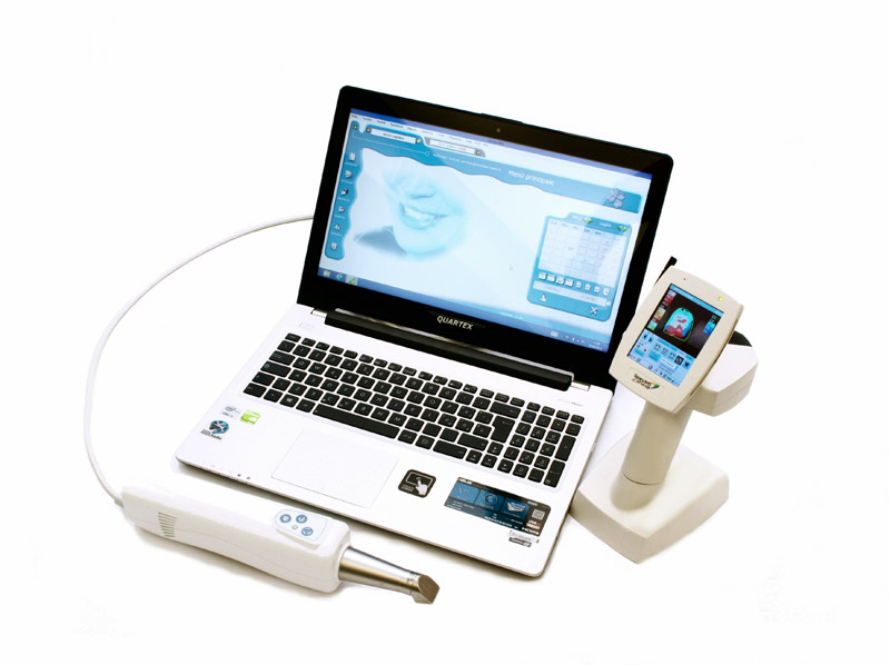 scanner_intraorale_04