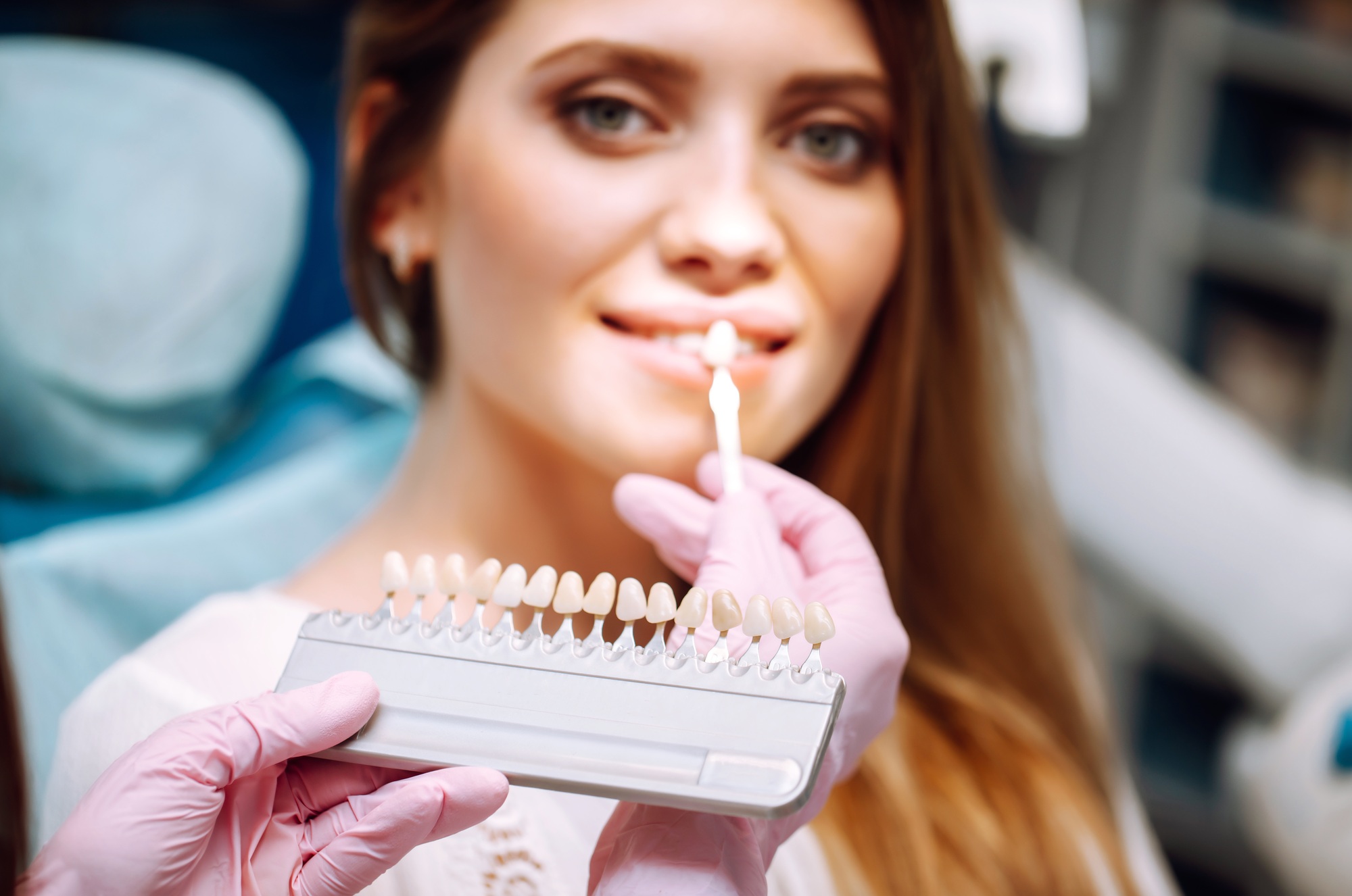 Quanto costano le faccette dentali?