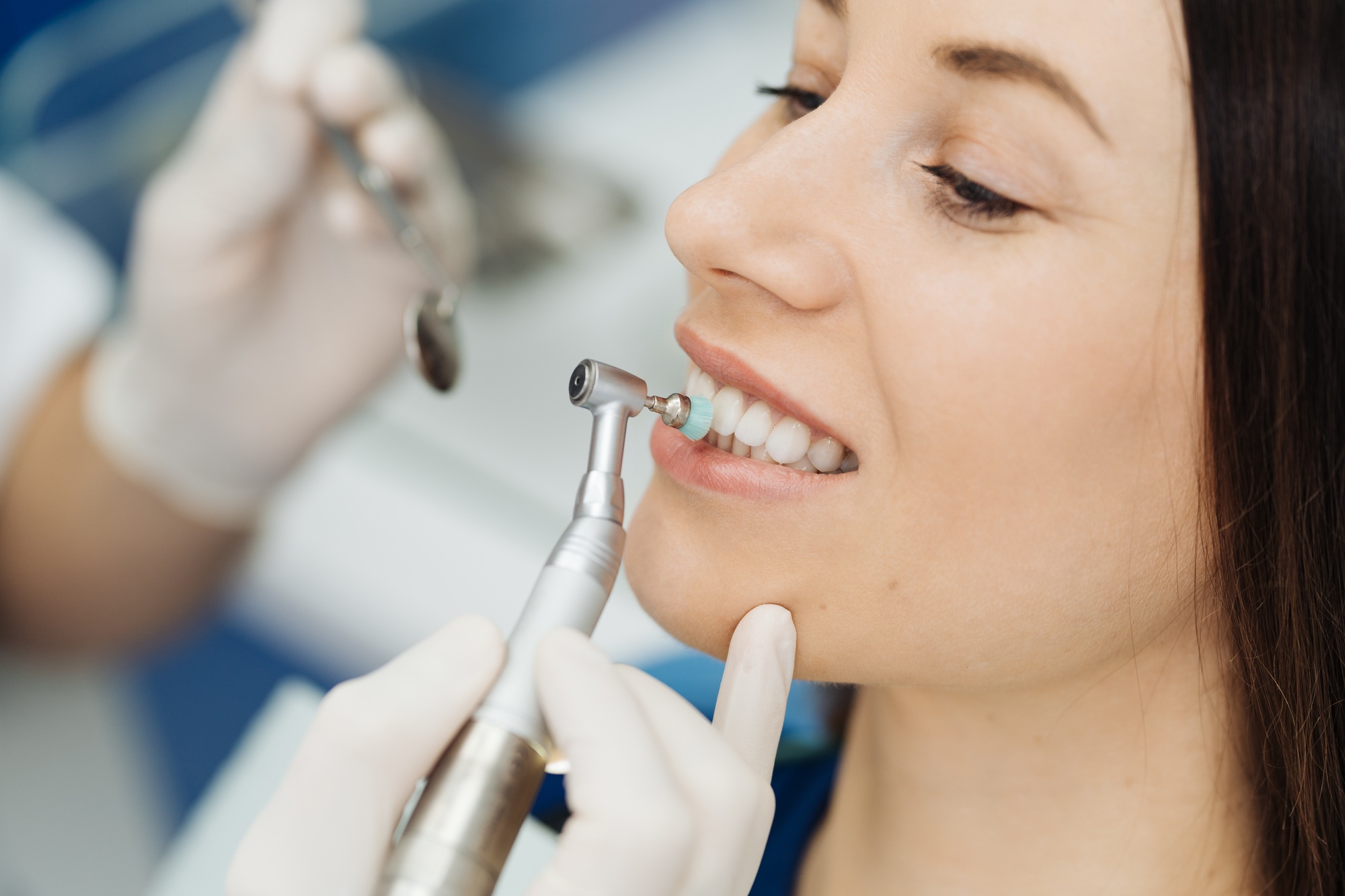 Pulizia dentale Roma